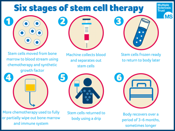 Read Latest News - Stem Cell Transplant Effective for Select MS Patients.