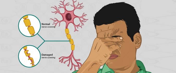 multiple-sclerosis-treatment