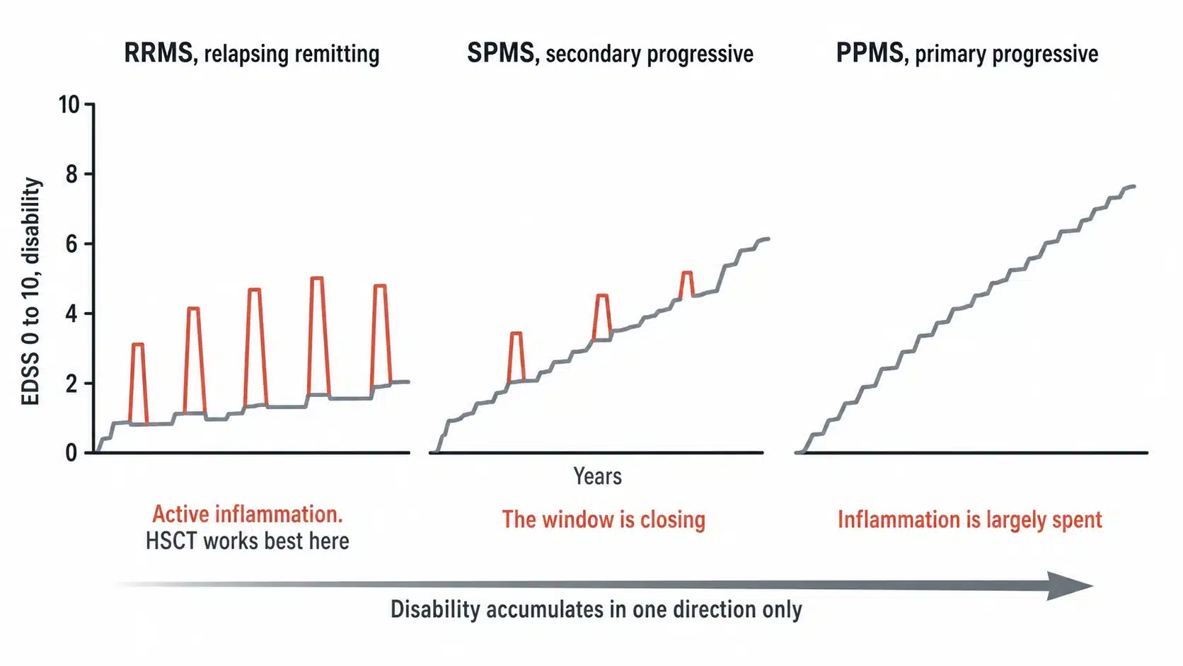 The stages of multiple sclerosis, showing how relapsing remitting MS can progress to secondary progressive MS, and how primary progressive MS differs.