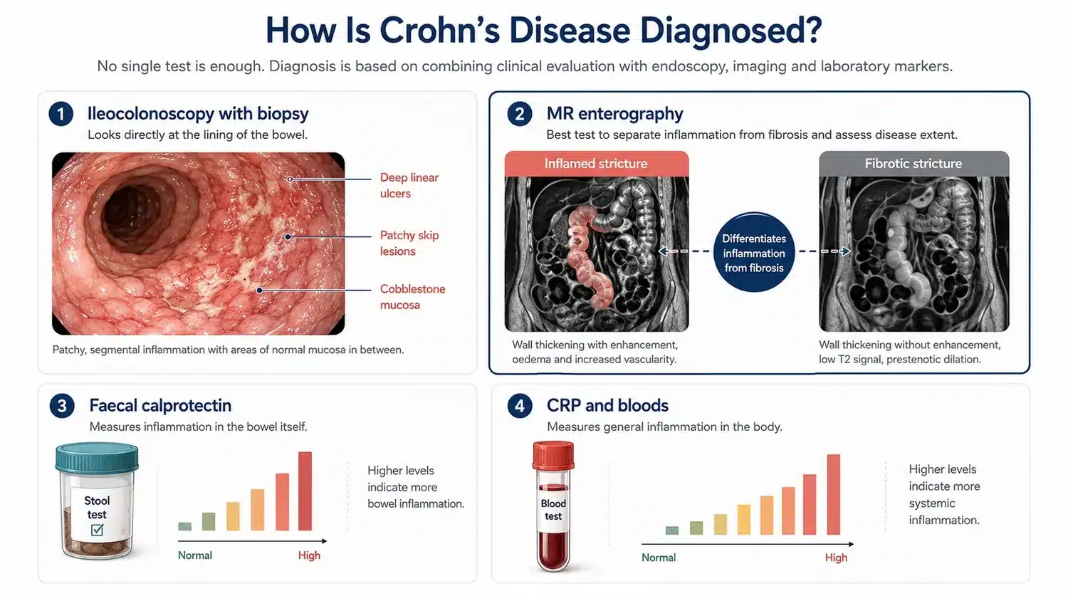 The tests used to diagnose Crohn's disease and to distinguish active inflammation from fibrotic scarring.