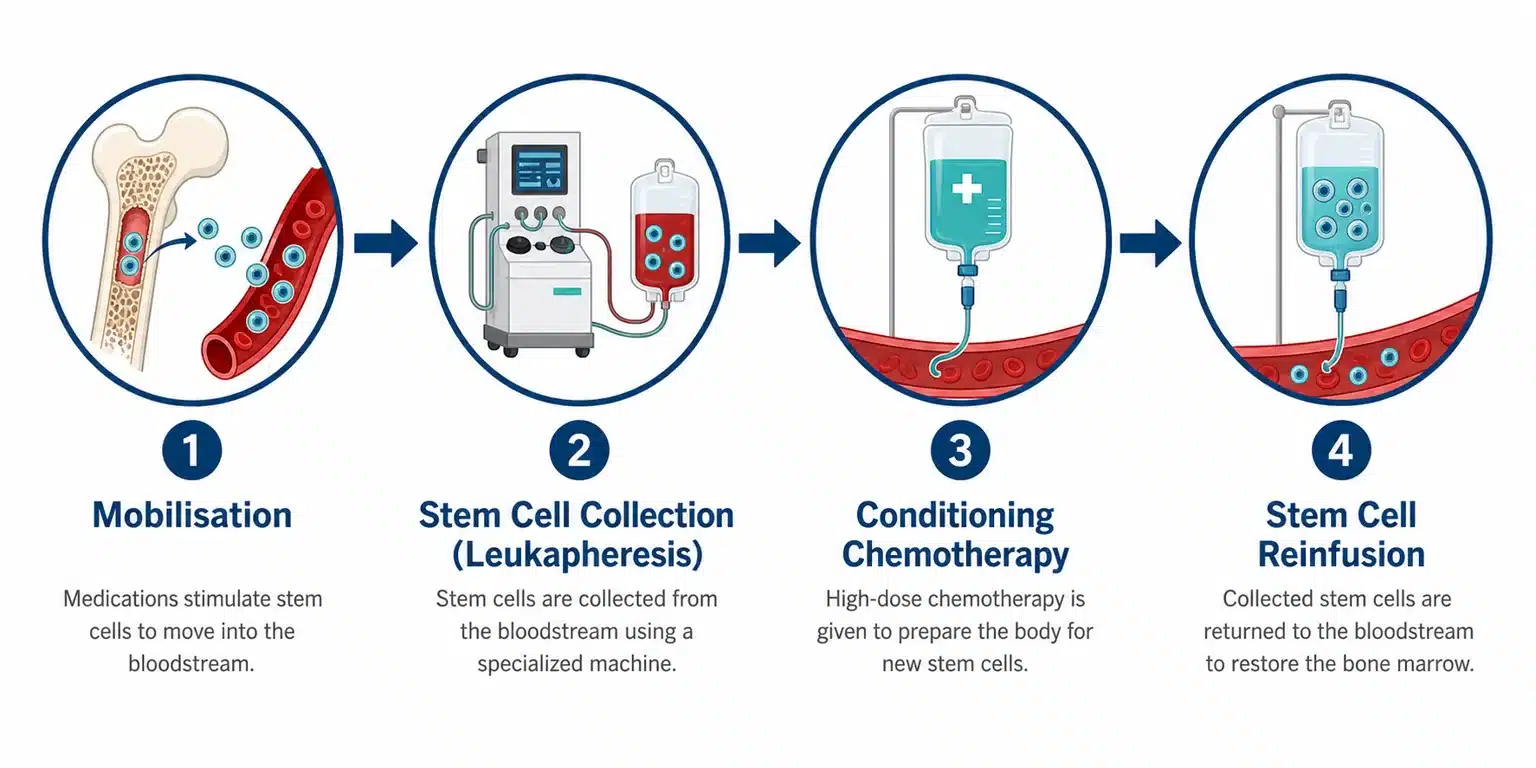 The four stages of an autologous transplant for myositis: mobilisation, harvest by leukapheresis, conditioning and reinfusion