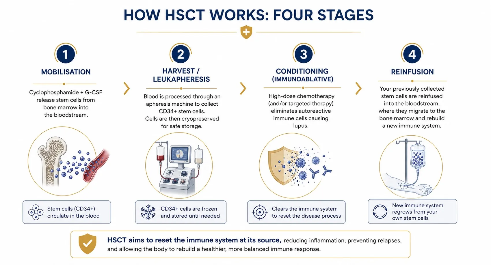 The four stages of a stem cell transplant for lupus: mobilisation, harvest by leukapheresis, immunoablative conditioning and reinfusion