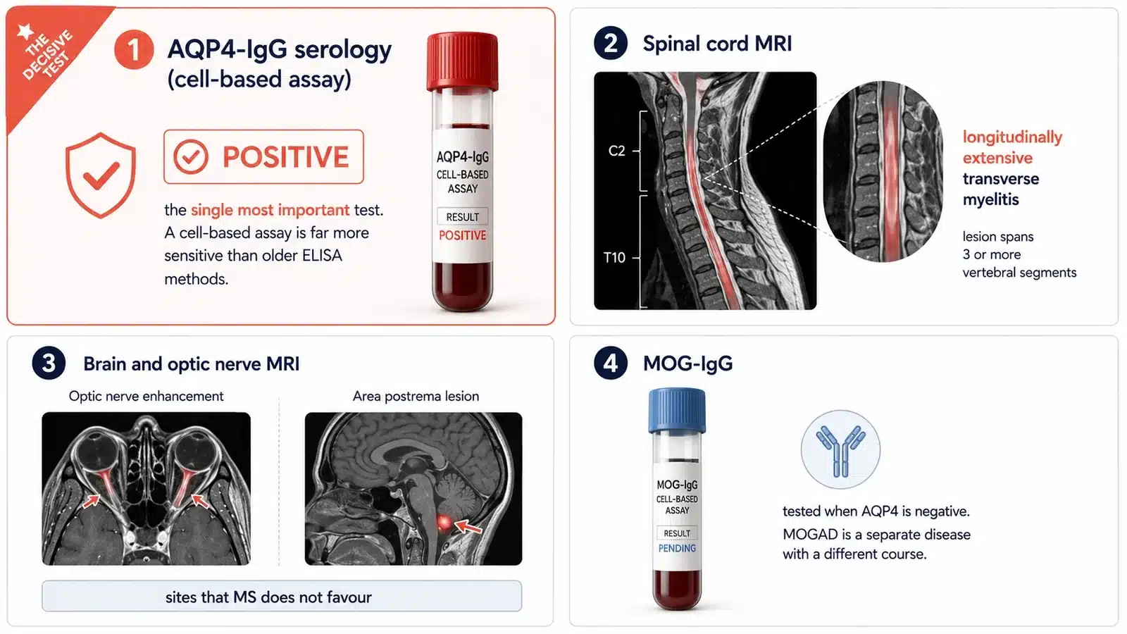 The tests used to diagnose NMOSD, including AQP4-IgG antibody serology and spinal cord MRI.