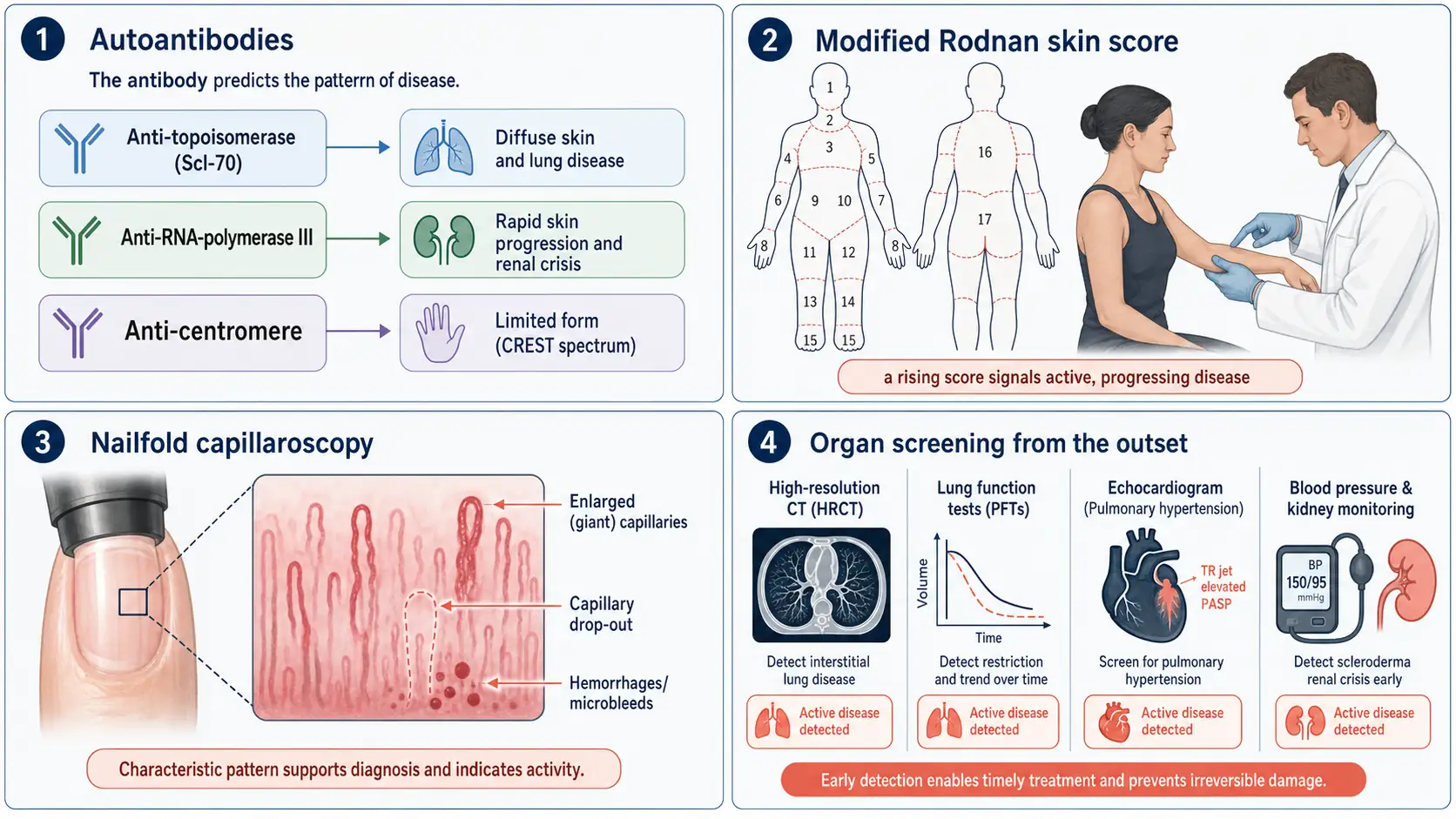 The tests used to diagnose scleroderma: autoantibodies, the modified Rodnan skin score, nailfold capillaroscopy, and screening of the lungs, heart and kidneys.