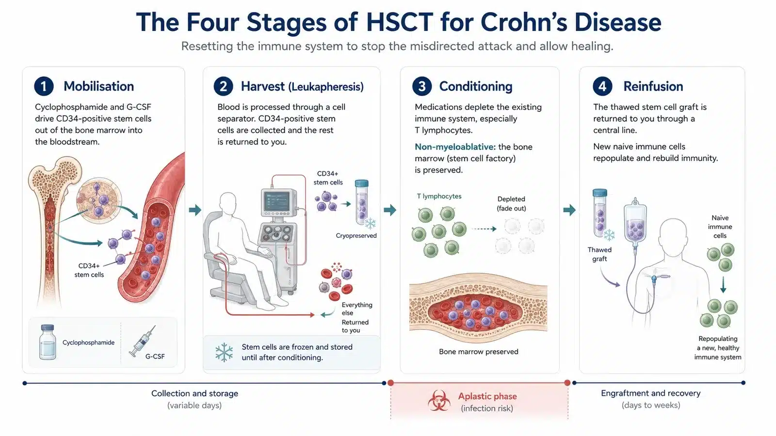 Crohn's disease new treatment: the four stages of a stem cell transplant, mobilisation, harvest, conditioning and reinfusion.