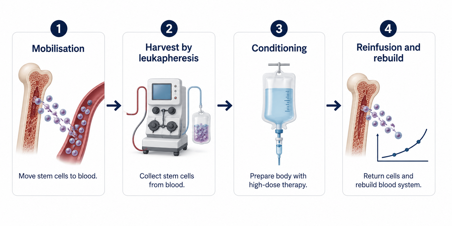 The four stages of a stem cell transplant for MS, mobilisation, harvest, conditioning and reinfusion