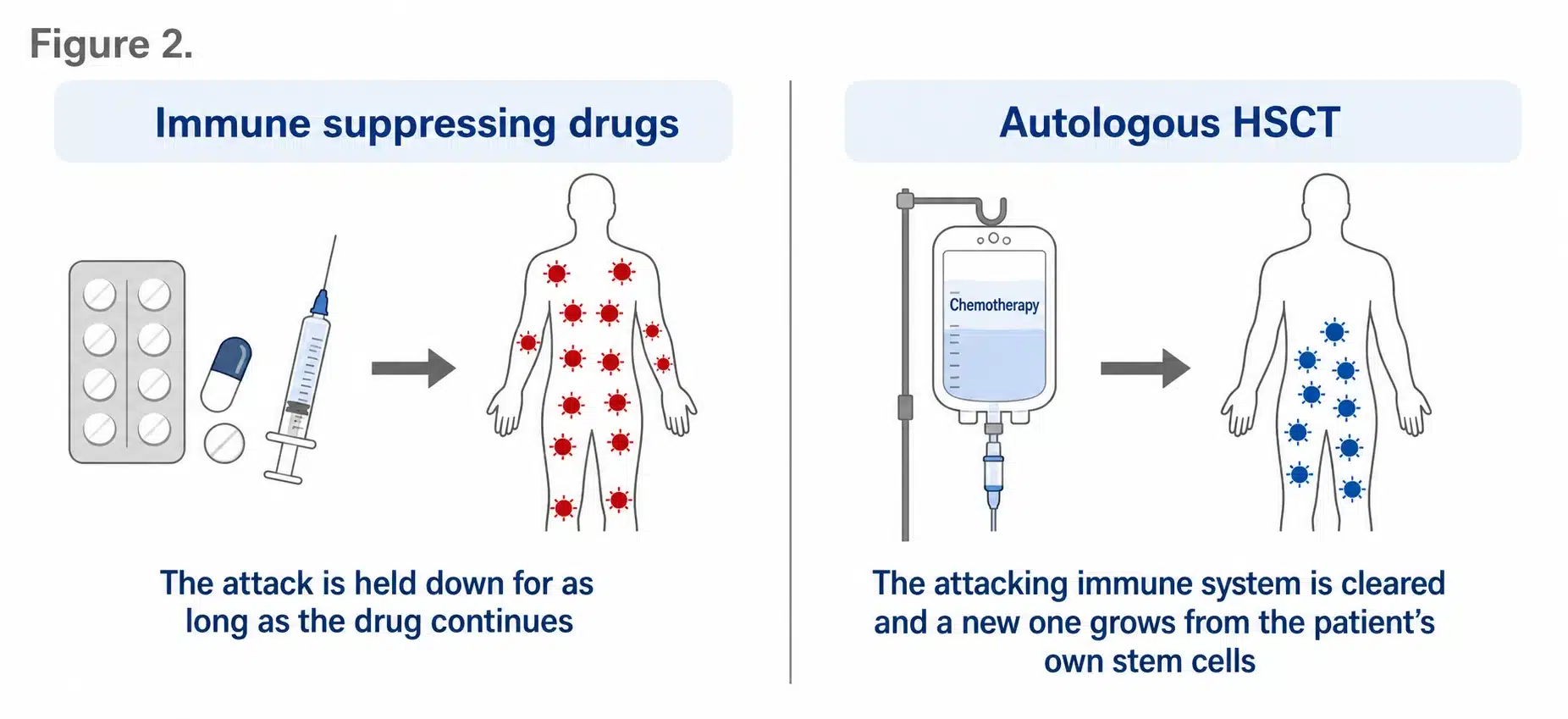How immune suppressing drugs hold down an autoimmune attack while autologous HSCT clears the attacking immune system and allows the patient's own stem cells to rebuild a new one.