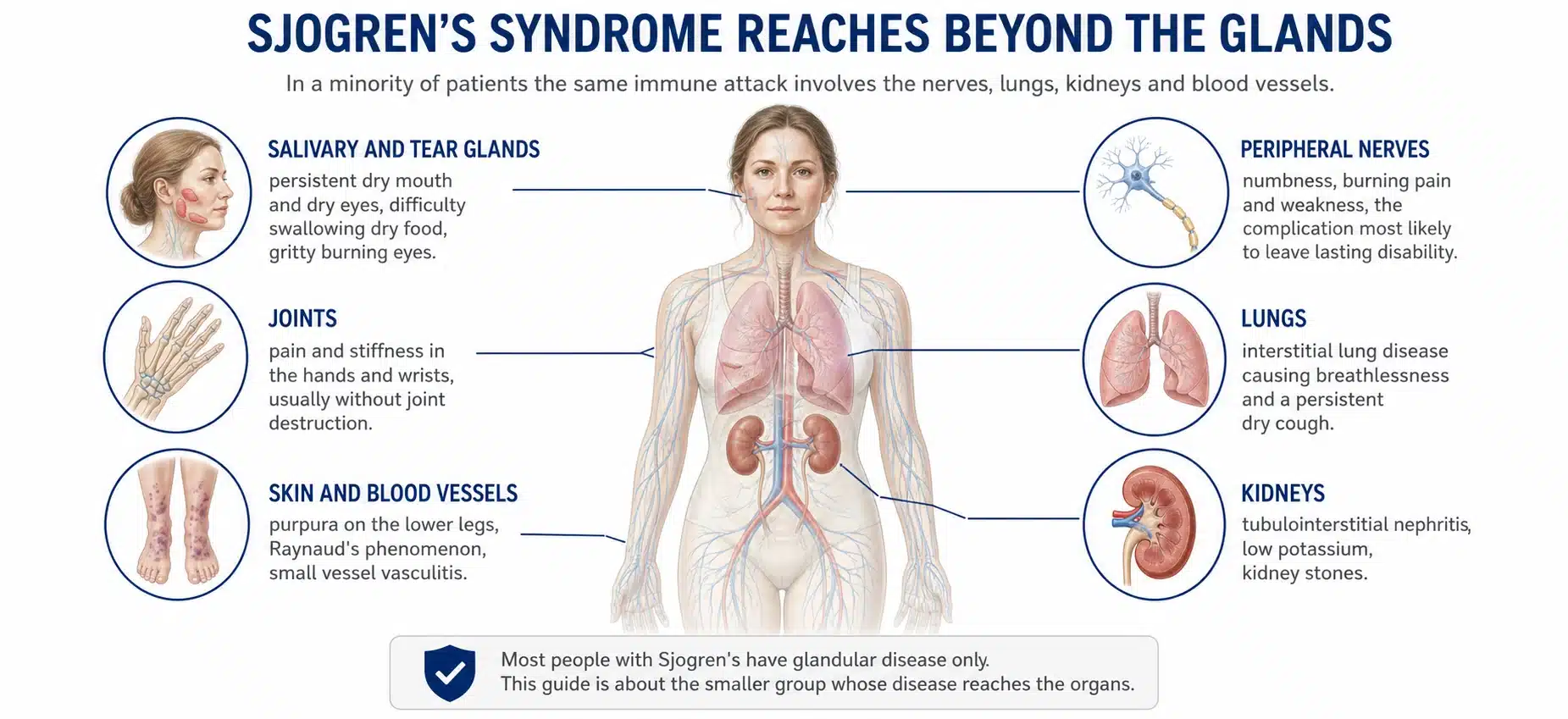 Organs affected by systemic Sjogren's syndrome, the peripheral nerves, lungs, kidneys, joints, skin and blood vessels.
