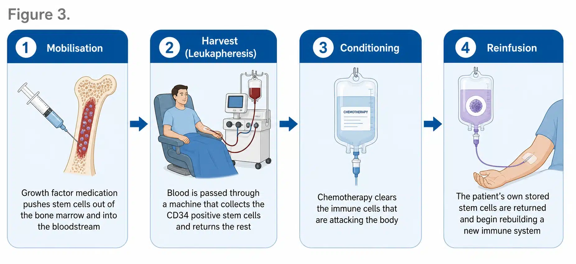 The four stages of autologous HSCT, mobilisation, harvest by leukapheresis, conditioning and reinfusion of the patient's own stem cells.