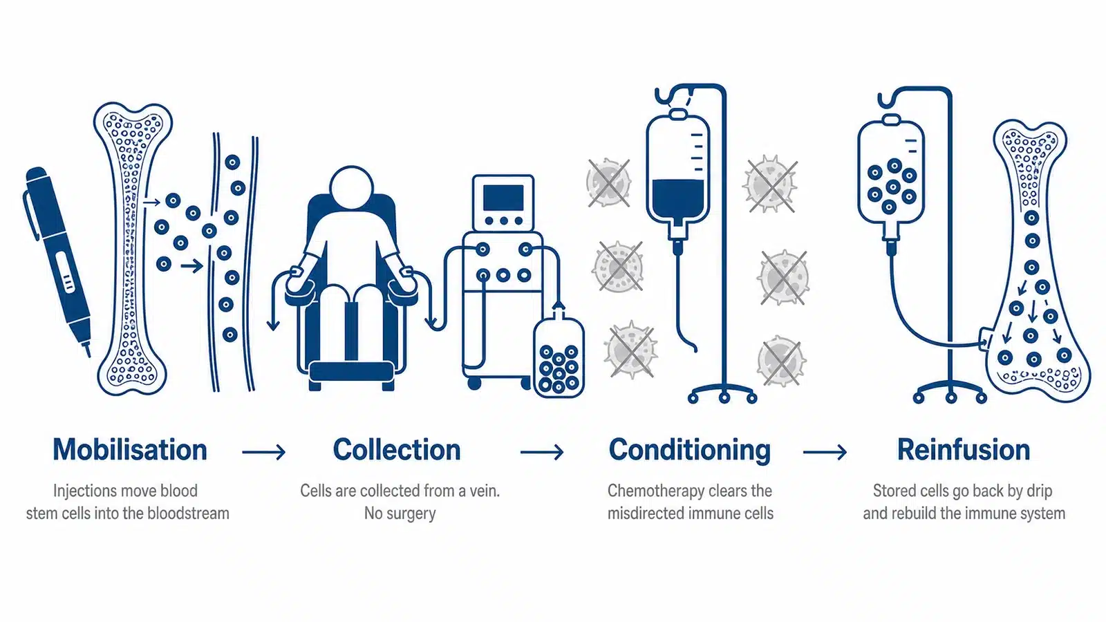 The four stages of HSCT for multiple sclerosis, mobilisation moving blood stem cells out of the bone marrow, collection of those cells from a vein through a machine with no surgery, conditioning chemotherapy clearing the misdirected immune cells, and reinfusion where the stored cells are returned by drip and rebuild a new immune system over about two weeks