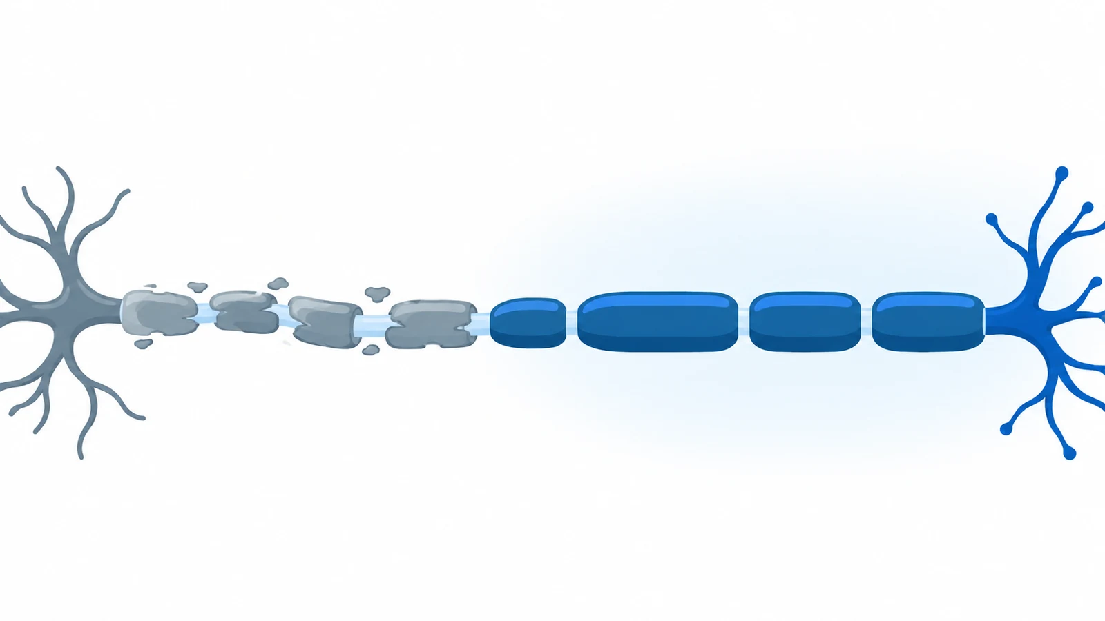 CIDP treatment options: a nerve fibre with damaged myelin on one side and a restored myelin sheath on the other