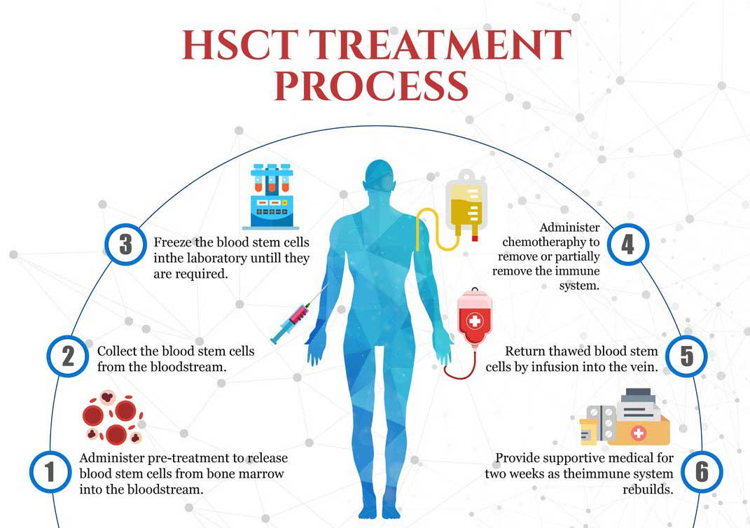 The image outlines the stages of HSCT treatment for CIDP